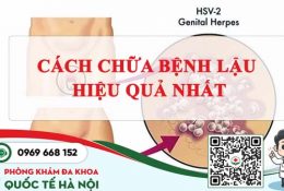 cach-chua-benh-lau-hieu-qua-nhat