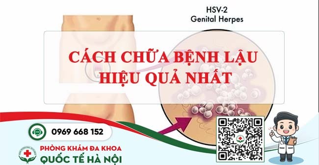 cách chữa bệnh lậu