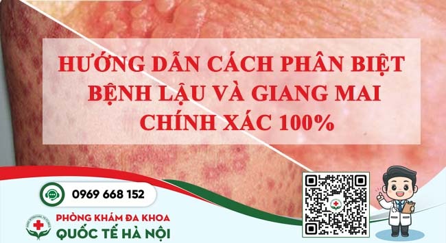 cách phân biệt bệnh lậu và giang mai