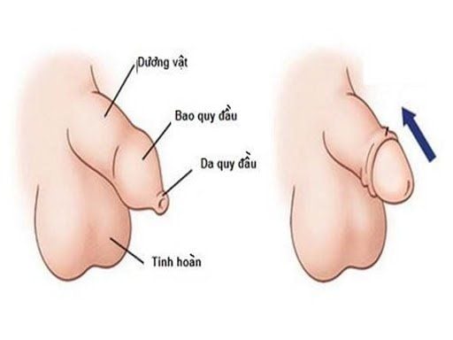 CÁCH VỆ SINH BAO QUY ĐẦU ĐÚNG CÁCH LÀ NHƯ THẾ NÀO? 1 cách vệ sinh bao quy đầu đúng cách là như thế nào để không bị viêm nhiễm?