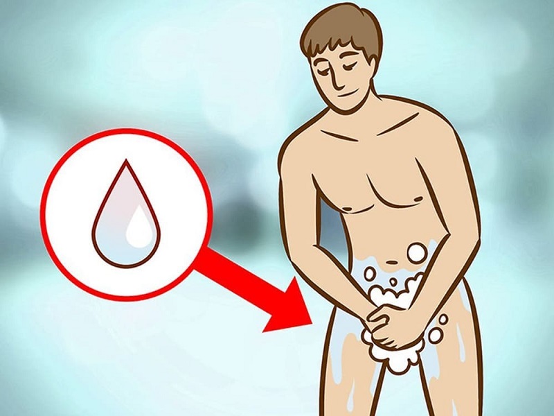 CÁCH VỆ SINH BAO QUY ĐẦU ĐÚNG CÁCH LÀ NHƯ THẾ NÀO? 2 CÁCH VỆ SINH BAO QUY ĐẦU ĐÚNG CÁCH LÀ NHƯ THẾ NÀO?