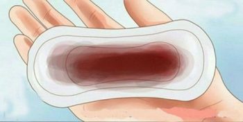 CÓ NÊN ĐI KHÁM PHỤ KHOA KHI ĐANG HÀNH KINH? 1 co nen di kham khi dang hanh kinh 1