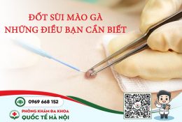 dot-sui-mao-ga