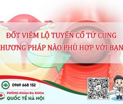 dot-viem-lo-tuyen