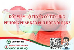dot-viem-lo-tuyen