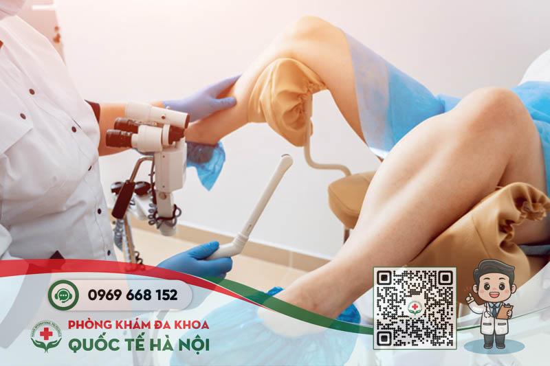 viêm lộ tuyến cổ tử cung