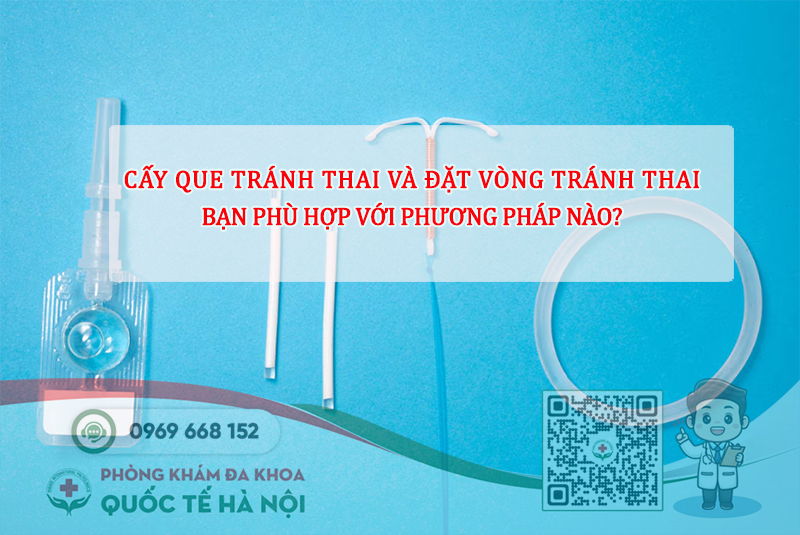 cấy que tránh thai và đặt vòng tránh thai