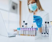 xet-nghiem-benh-xa-hoi