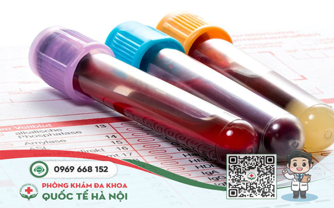 Xét nghiệm bệnh xã hội là gì? Khi nào cần khám và chi phí bao nhiêu? 1 Xét nghiệm bệnh xã hội